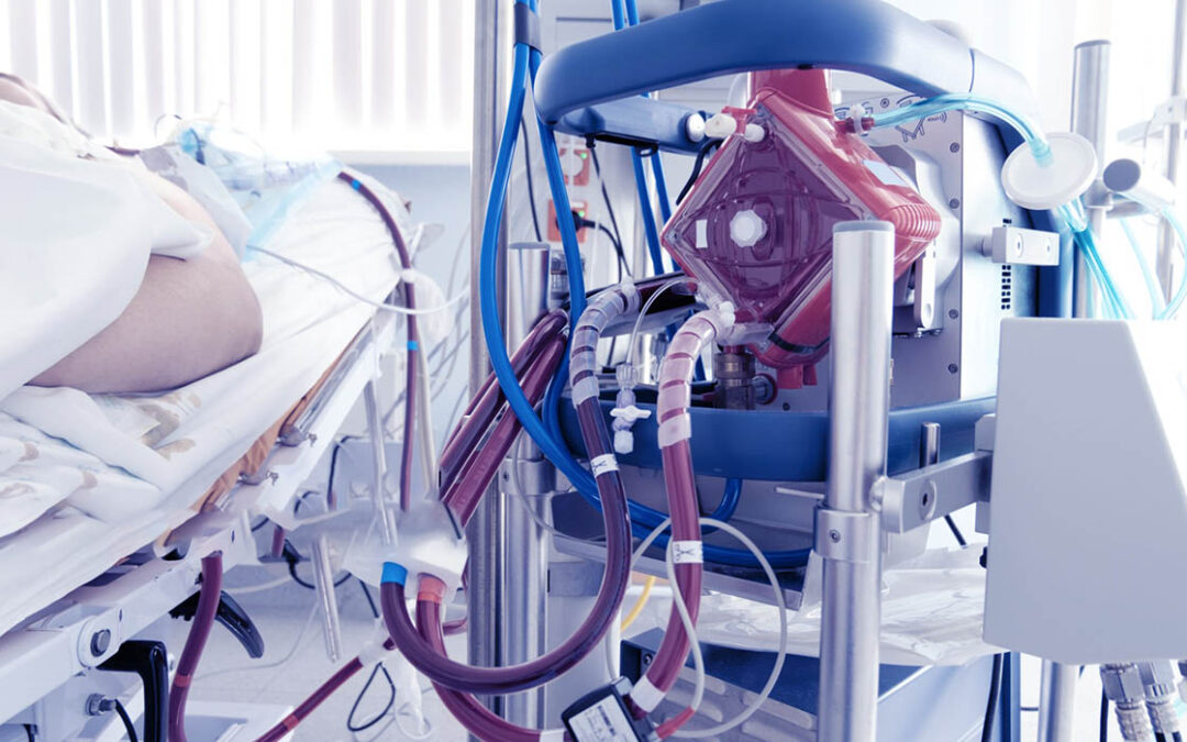 ECMO-tecnologia, applicazioni cliniche, vantaggi, limiti e costi
